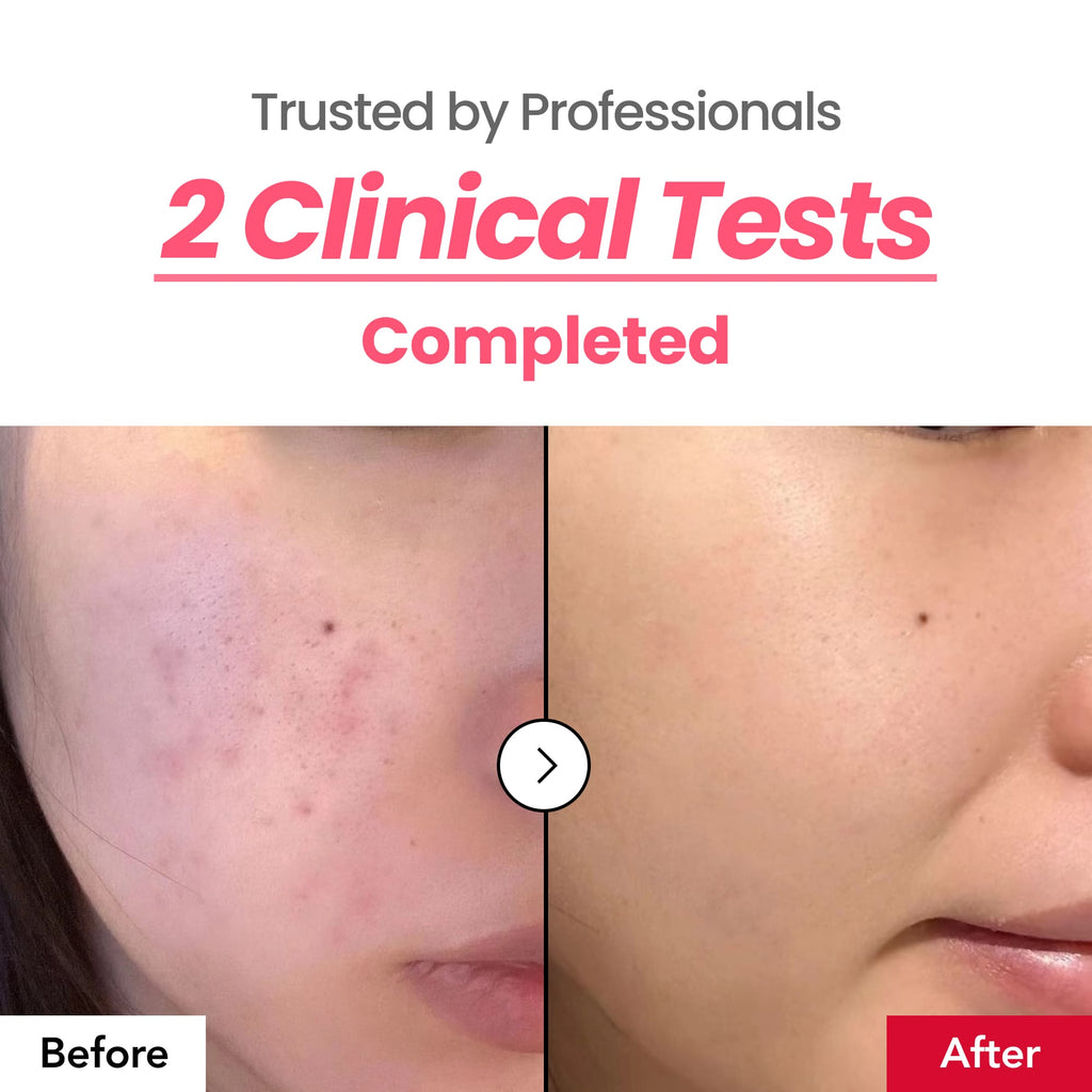 Dr.Percent Dark Spot 24% Correcting Pink Glow Cream 30ml