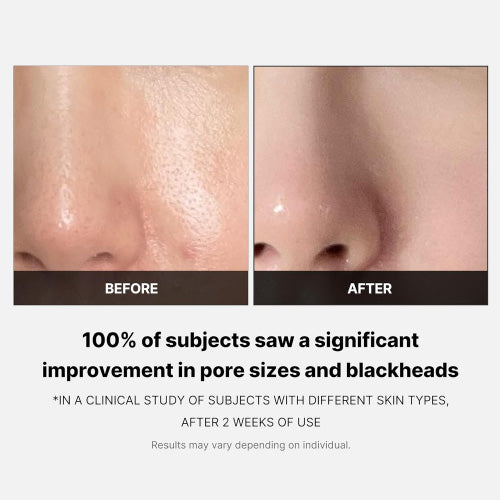 MEDICUBE Zero Pore Pad 2.0 (70ea)