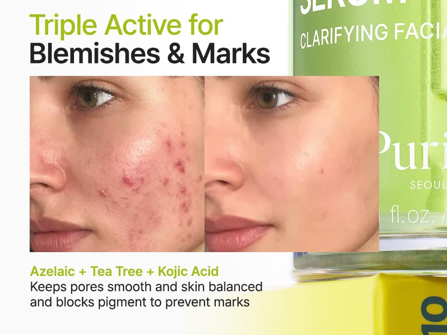 Purito Seoul Azelaic Acid 10 Kojic Azulene Serum 30ml