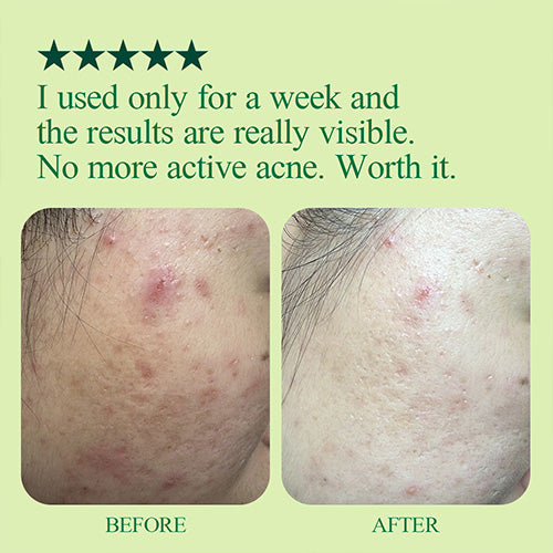 Pyunkang Yul Ultimate Calming Solution Ampoule 30ml